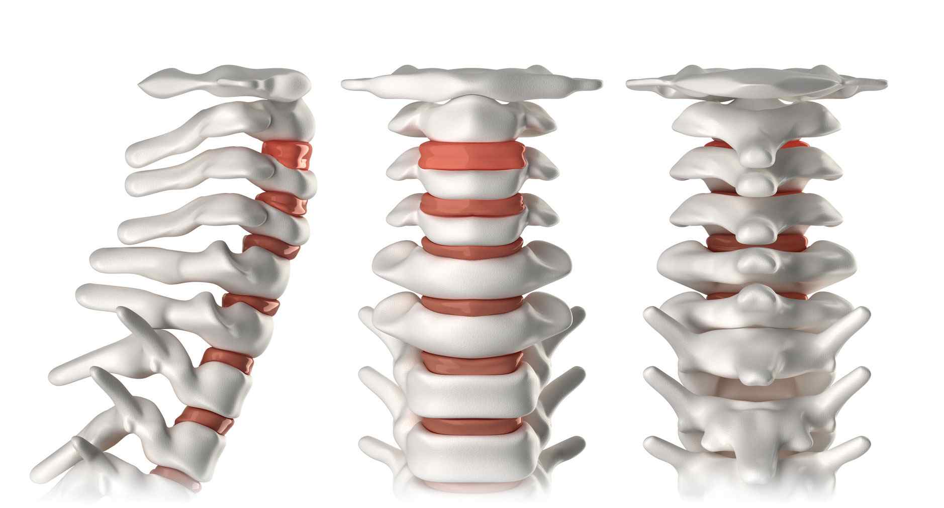 https://www.albertoalbert.com/wp-content/uploads/2015/12/tratamiento-integral-dolor-columna-vertebral-cervical-y-lumbar.jpg